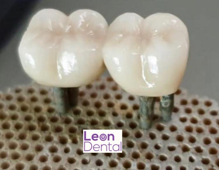 estetska-stomatologija